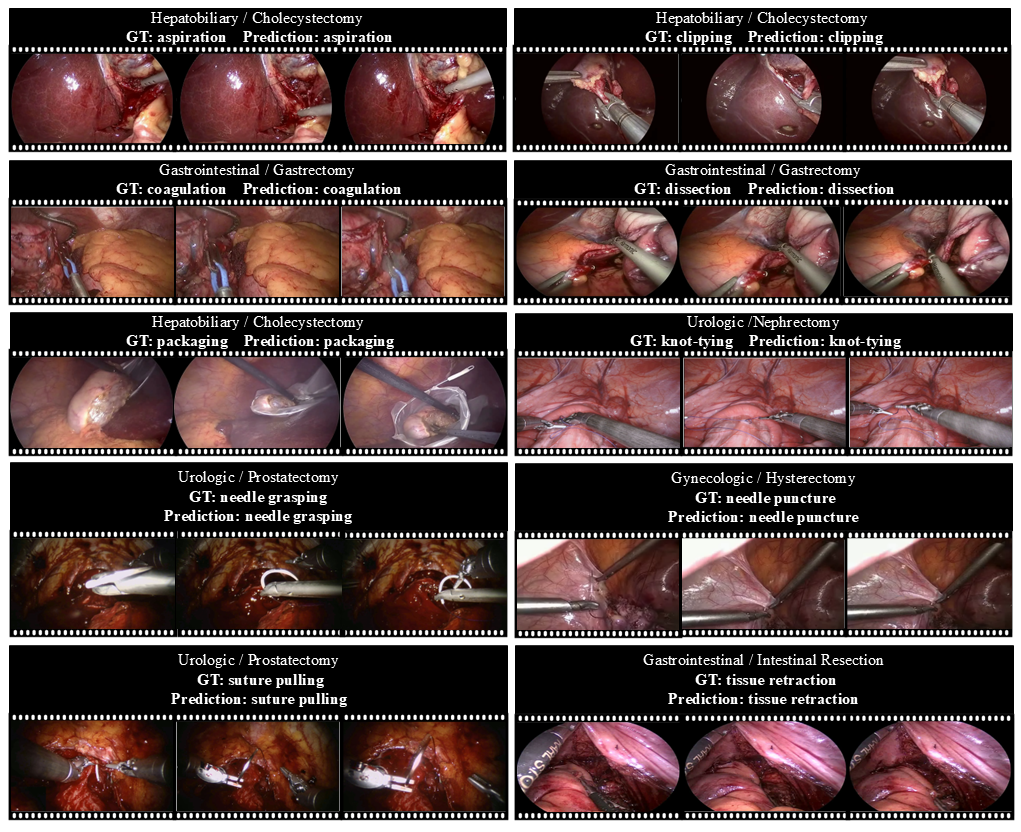 Qualitative visualization of BSA model predictions